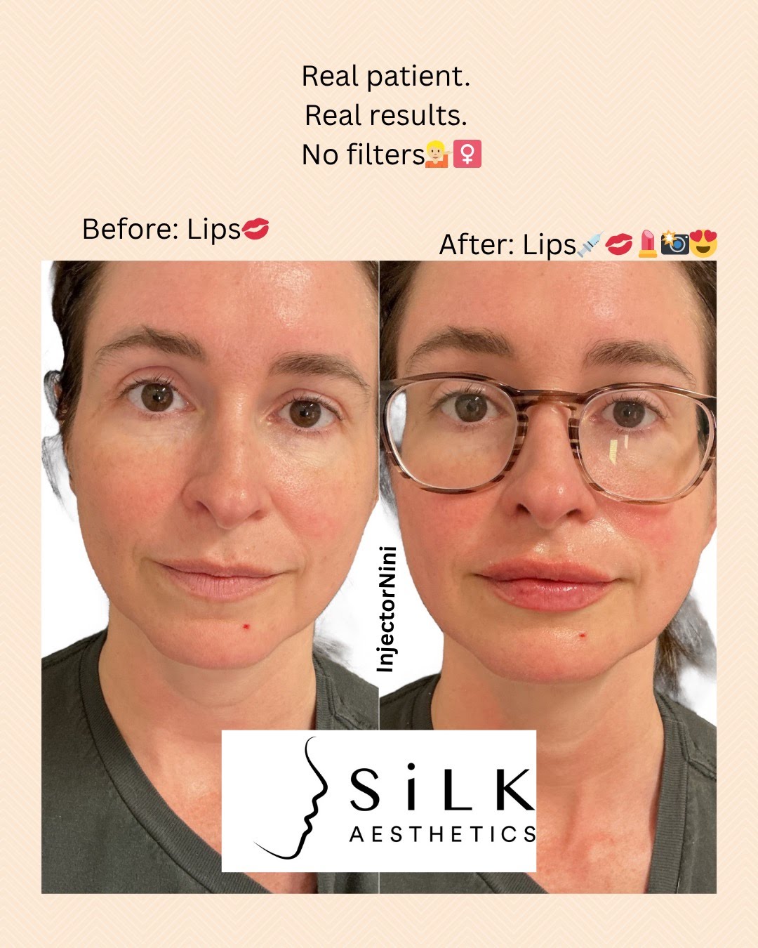Treatment results